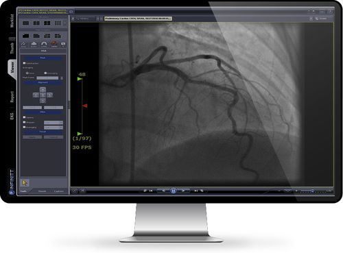 Software di analisi - Cath Lab - INFINITT North America - di gestione / medico / per cardiologia