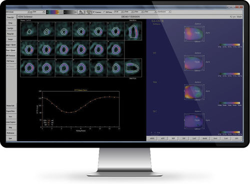 Software per reportistica - INFINITT North America - visualizzatore / di post elaborazione / clinico
