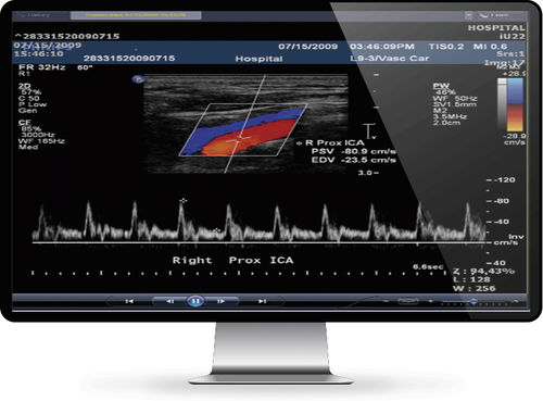 Software di gestione dati - INFINITT North America - medico / per ospedale / per cardiologia