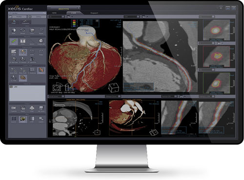Software di analisi - Xelis™ Cardiac - INFINITT North America - di visualizzazione 3D / diagnostico / di misura