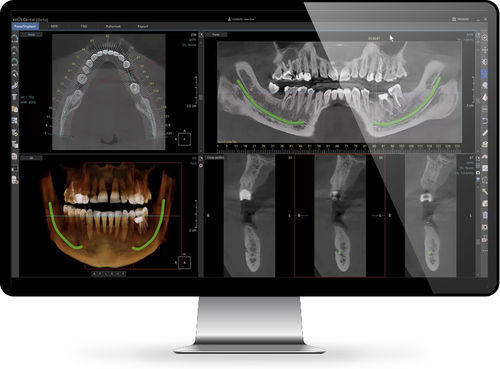 Software per reportistica - Xelis™   - INFINITT North America - di visualizzazione / diagnostico / di pianificazione