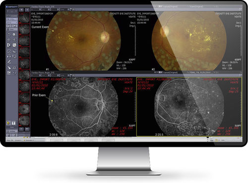 PACS per diagnostica per immagini - Ophthalmology - INFINITT North America - basato sul web