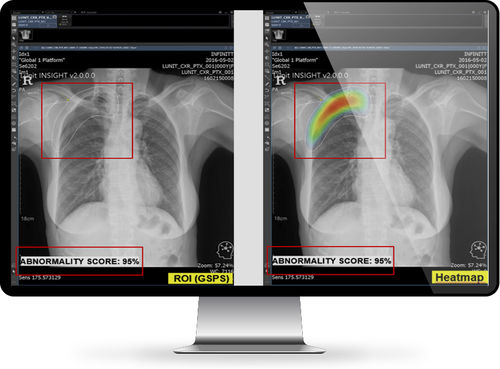 Software di analisi delle immagini - INFINITT North America - visualizzatore / medico / per radiologia