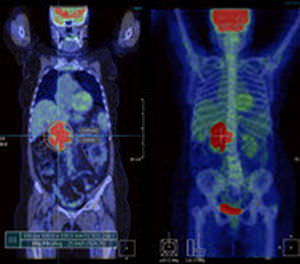 Software di analisi - Xelis™ Fusion - INFINITT North America - di visualizzazione 3D / di fusione d'immagini multimodali / per diagnostica per immagini