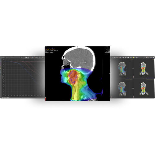 Software di monitoraggio di dosi di radiazioni - MIM SureCalc® MonteCarlo - MIM Software - di misura / di pianificazione / di trattamento