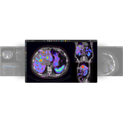Software di anatomia - MIM SurePlan™ MRT - MIM Software - per medicina nucleare / per reportistica / di monitoraggio di dosi di radiazioni