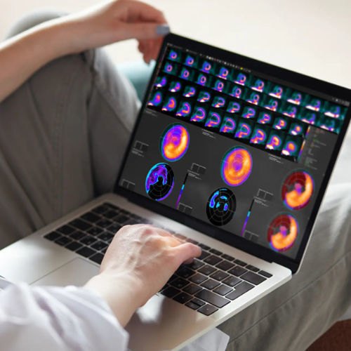 Software clinico - MIMcardiac® - MIM Software - per tomografia computerizzata / TEP / SPECT