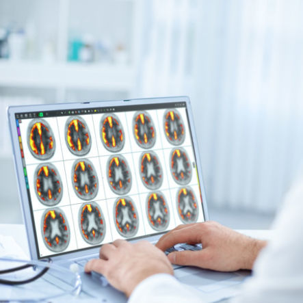 Software per imaging cerebrale - MIMneuro® - MIM Software - di analisi / di visualizzazione 3D / diagnostico