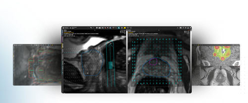 Software di visualizzazione 3D - MIM Symphony LDR™ - MIM Software - di acquisizione / di pianificazione / di pianificazione del trattamento