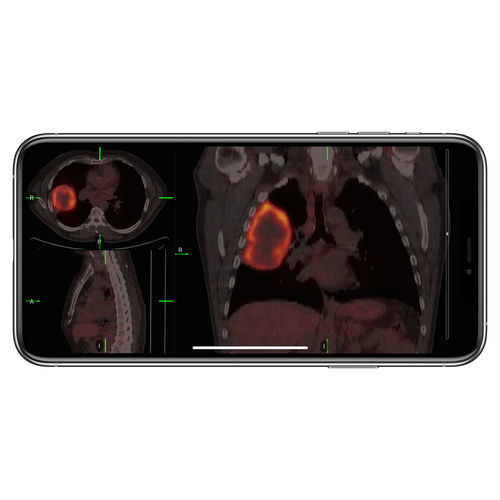 Applicazione iOS di controllo accessi - VueMe™ - MIM Software - d’importazione / per diagnostica per immagini / iOS