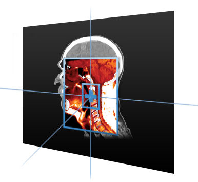 Software medico - MIM Maestro® - MIM Software - per radioterapia / di visualizzazione / di pianificazione