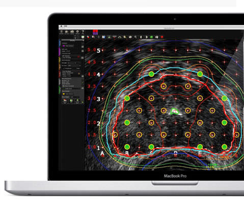 Software di analisi - MIM Symphony Dx™ - MIM Software - di gestione / per reportistica / di visualizzazione