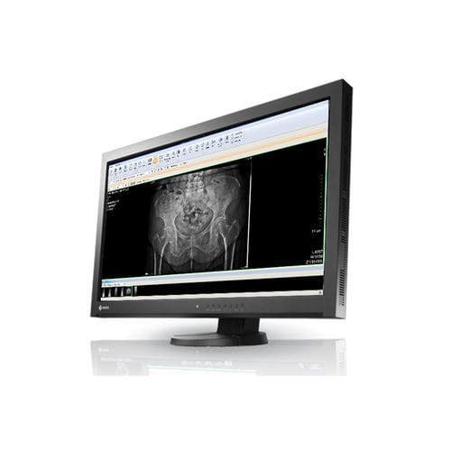 Workstation diagnostica - IDETEC MEDICAL IMAGING - per radiologia