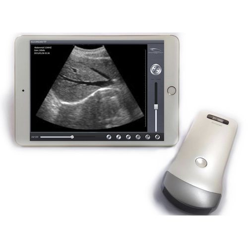 Ecografo palmare - SS-1, SS-2 - SonopTek - per ecografia multidisciplinare / con sonda wireless