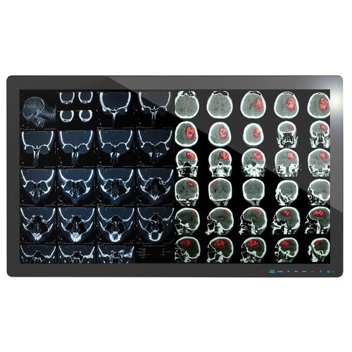 Monitor medico - 4K2K - Richardson Electronics - Healthcare - Full HD / 4K / 32"