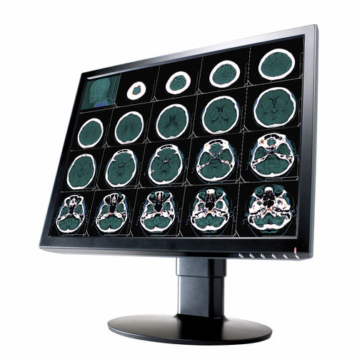 Monitor medico - 2 MP | CL2000 - Richardson Electronics - Healthcare - diagnostico / per radiologia / 20.1"