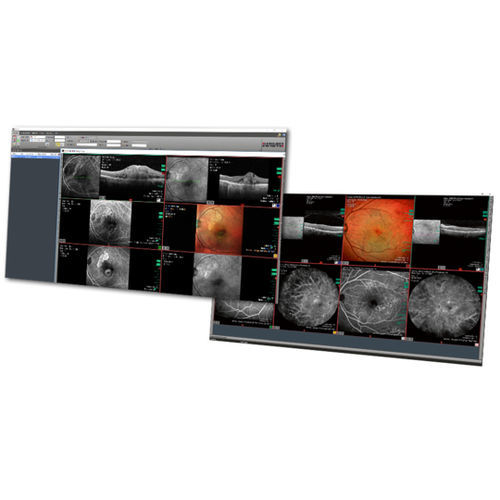 PACS medico - HEYEX  - Heidelberg Engineering