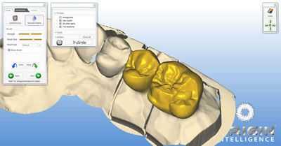 Software di progettazione di protesi dentale - ORIGIN HD - B&D Dental Technologies - CAD / FAO