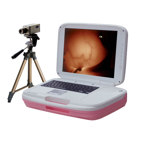 Videocolposcopio - AD-1202 - Xuzhou Kejian Hi-tech - portatile