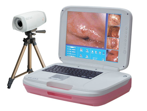 Videocolposcopio - AD-2000Y  - Xuzhou Kejian Hi-tech - portatile