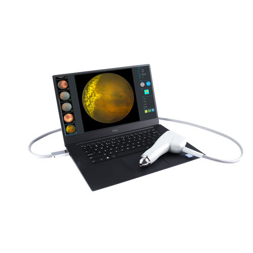 Telecamera retinica non-midriatica - SW-8000P - Tianjin Suowei Electronic Technology - angiografia a fluorescenza con fluoresceina / palmare