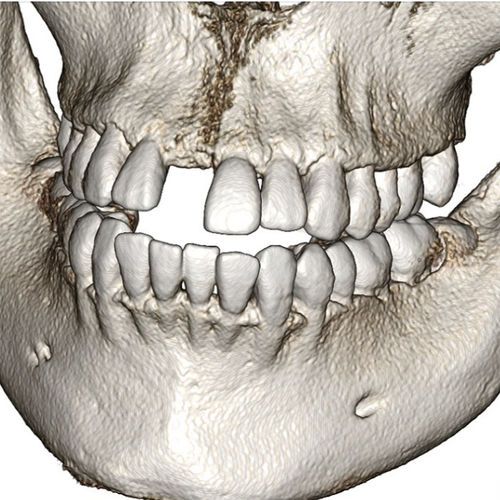 Software odontoiatrico -  Invivo6 - Anatomage - medico / per tomografia computerizzata / di analisi