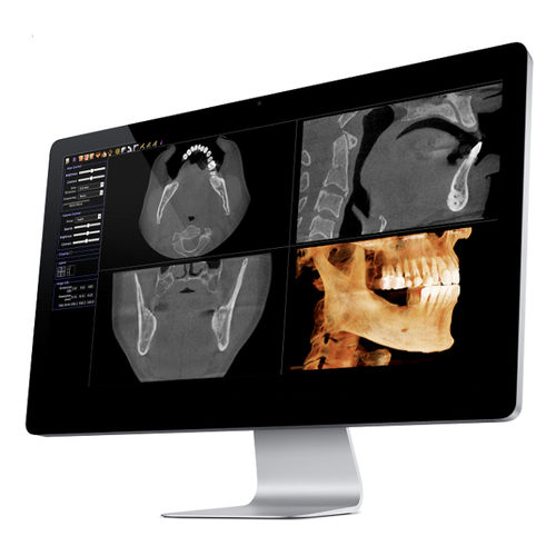 Software medico - Invivo - Anatomage - per tomografia computerizzata / TEP / universale