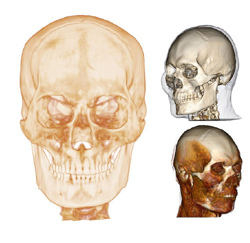 Software medico - Medical Design Studio - Anatomage - di anatomia / di visualizzazione 3D / di progettazione