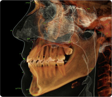 Modulo software per imaging odontoiatrico - Anatomage - ortodontico / chirurgico / di analisi cefalometrica