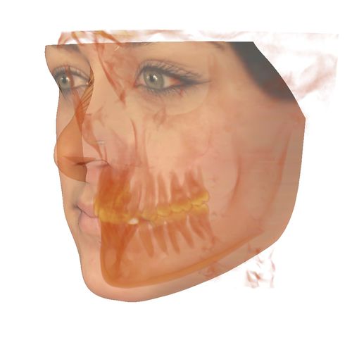 Software di anatomia - Anatomodel - Anatomage - per imaging odontoiatrico / di file DICOM / ortodontico