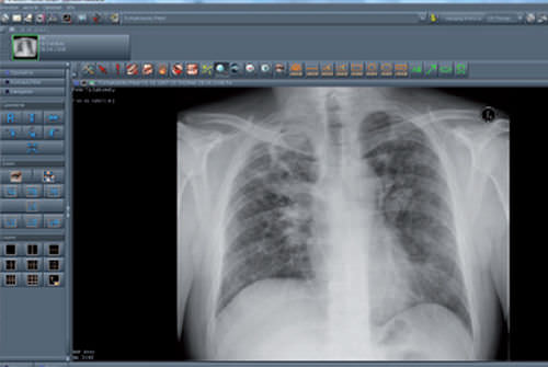Software di visualizzazione - NEXUS / PACS - Nexus AG - per PACS / medico / per ospedale
