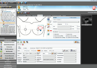 Software di gestione - NEXUS / OBSTETRICS - Nexus AG - per esami ginecologici / per esami ostetrici