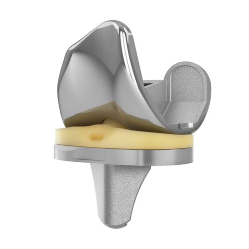 Protesi di ginocchio tricompartimentale - EMPOWR PS ® - Trilliant Surgical - a piatto fisso