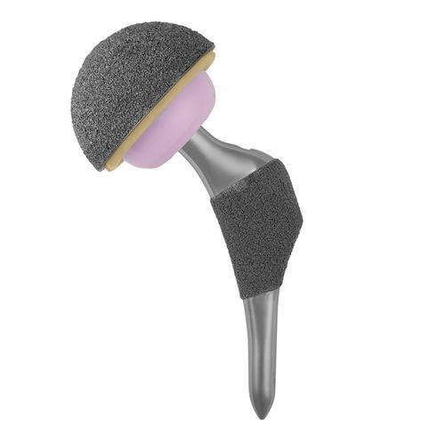 Protesi di anca minivasiva - REVELATION® MICROMAX™ - Trilliant Surgical - non cementata / destra / sinistra