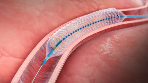 Stent coronarico - DESolve™ - Elixir Medical - in PLLA / bioassorbibile