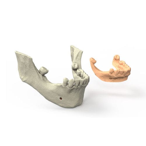 Software odontoiatrico - 3DIEMME - di progettazione di protesi dentale / di simulazione d'impianto dentale / per chirurgia