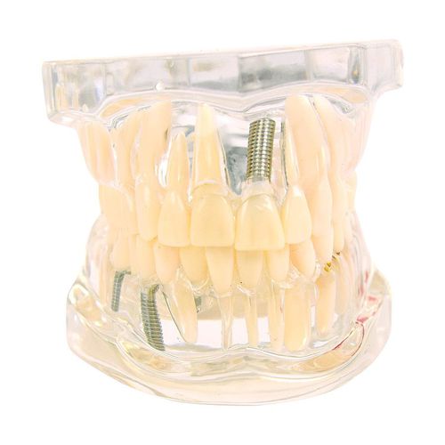 Modello anatomico di denti - H139074  - HeineScientific® - odontoiatrico / di mandibola / odontoiatrico
