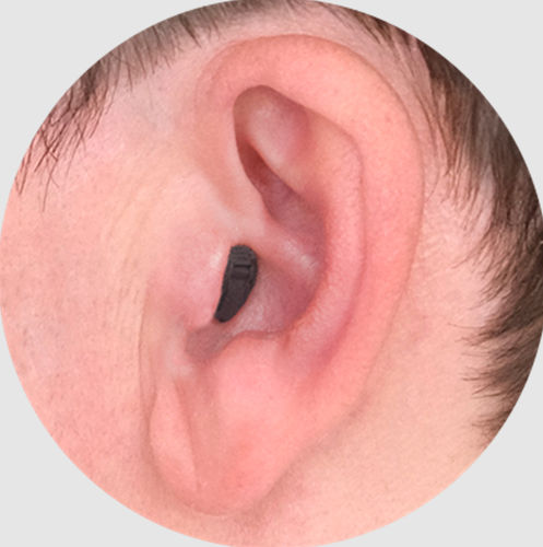 Audioprotesi CIC - ReSound - wireless / ricaricabile