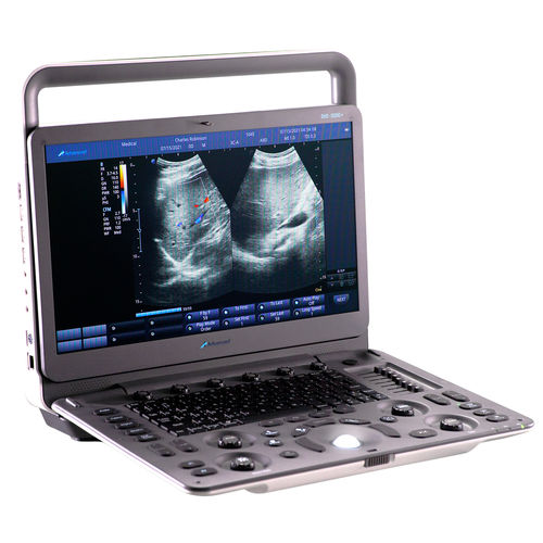 Ecografo portatile - DUS – 5000 + - Advanced Instrumentations - per ecografia ginecologica ed ostetrica / per ecografia addomino-pelvica / per ecografia cardiovascolare