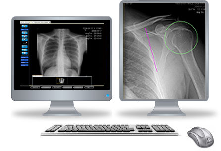 PACS per diagnostica per immagini - Clarity  - iCRco - medico