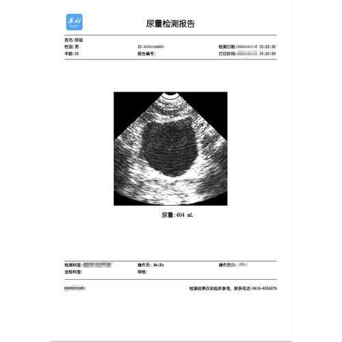 Software di masterizzazione - Mianyang Meike Electronic Equipment - di sicurezza / di verifica / urologia