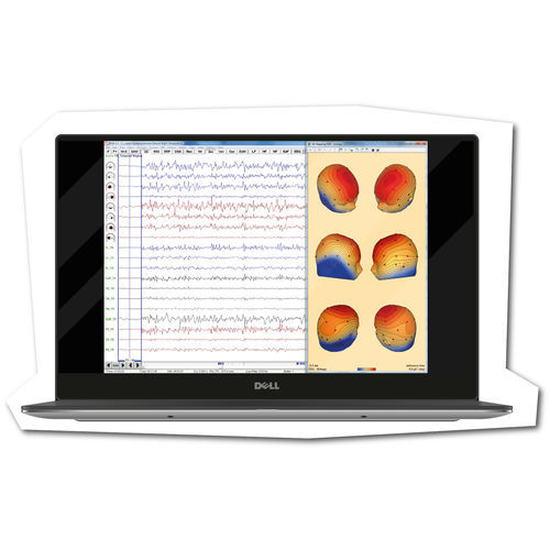 Software medico - BESA - Brainbox - per EEG / da ricerca / di analisi