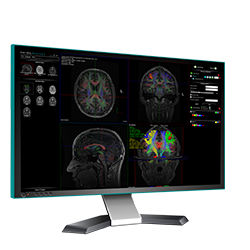 Software medico - nordicBrainEx - NordicNeuroLab - MRI / per MRI funzionale / di analisi