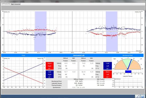 Software diagnostico - PRO-Line  - Instrumentation DIFRA - medico / di piede