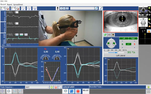 Software di prova - Instrumentation DIFRA - rieducazione vestibolare