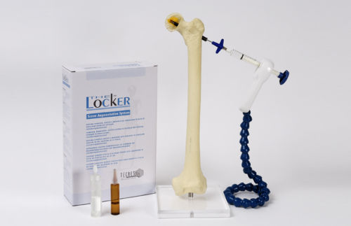 Strumentario chirurgico per iniezione di cemento osseo - Locker - Tecres - monouso