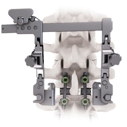 Divaricatore per chirurgia ortopedica - CALYPSO™ - Life Spine