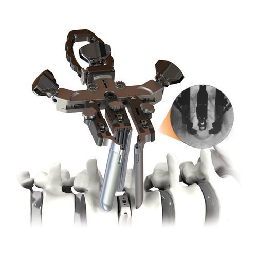 Divaricatore per chirurgia ortopedica - CENTRIC® - Life Spine - di anatomia