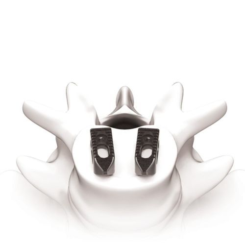 Gabbia intersomatica toraco-lombare - PLATEAU®-Ti - Life Spine - via anteriore / in titanio