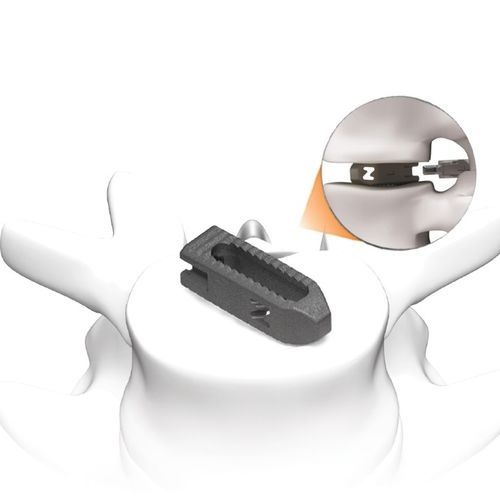 Gabbia intersomatica toraco-lombare - PLATEAU®-Z - Life Spine - via posteriore / via transforaminale / in titanio